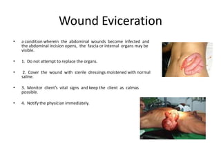 Wound Eviceration
•   a condition wherein the abdominal wounds become infected and
    the abdominal incision opens, the fascia or internal organs may be
    visible.

•   1. Do not attempt to replace the organs.

•    2. Cover the wound with sterile dressings moistened with normal
    saline.

•   3. Monitor client’s vital signs and keep the client as calmas
    possible.

•   4. Notify the physician immediately.
 