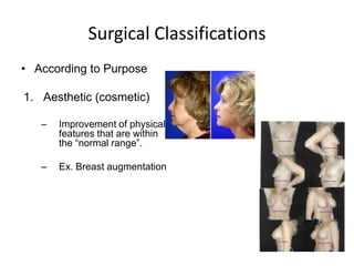 Surgical Classifications
• According to Purpose

1. Aesthetic (cosmetic)

   –   Improvement of physical
       features that are within
       the “normal range”.

   –   Ex. Breast augmentation
 