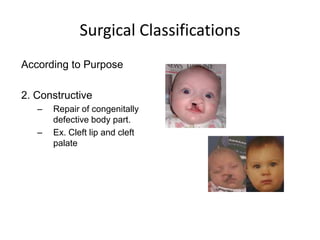 Surgical Classifications
According to Purpose

2. Constructive
   –   Repair of congenitally
       defective body part.
   –   Ex. Cleft lip and cleft
       palate
 