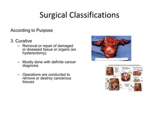 Surgical Classifications
According to Purpose

3. Curative
   – Removal or repair of damaged
     or diseased tissue or organs (ex
     hysterectomy).

   – Mostly done with definite cancer
     diagnosis

   – Operations are conducted to
     remove or destroy cancerous
     tissues
 