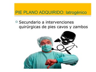 PIE PLANO ADQUIRIDO: Iatrogénico
 Secundario a intervenciones
quirúrgicas de pies cavos y zambos
 