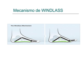 Mecanismo de WINDLASS
 