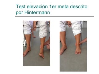 Test elevación 1er meta descrito
por Hintermann
 