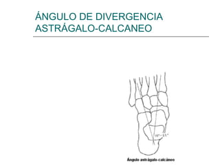 ÁNGULO DE DIVERGENCIA
ASTRÁGALO-CALCANEO
 