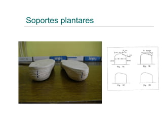 Soportes plantares
 