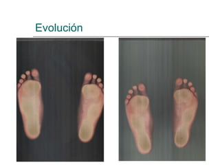 Evolución
 