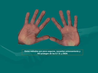Estos métodos son poco seguros, necesitan entrenamiento y NO protegen de las E.T.S. y SIDA 