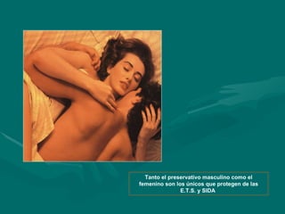 Tanto el preservativo masculino como el femenino son los únicos que protegen de las E.T.S. y SIDA  