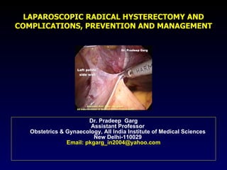 LAPAROSCOPIC RADICAL HYSTERECTOMY AND COMPLICATIONS, PREVENTION AND MANAGEMENT ,[object Object],[object Object]