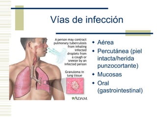 Vías de infección
 Aérea
 Percutánea (piel
intacta/herida
punzocortante)
 Mucosas
 Oral
(gastrointestinal)
 