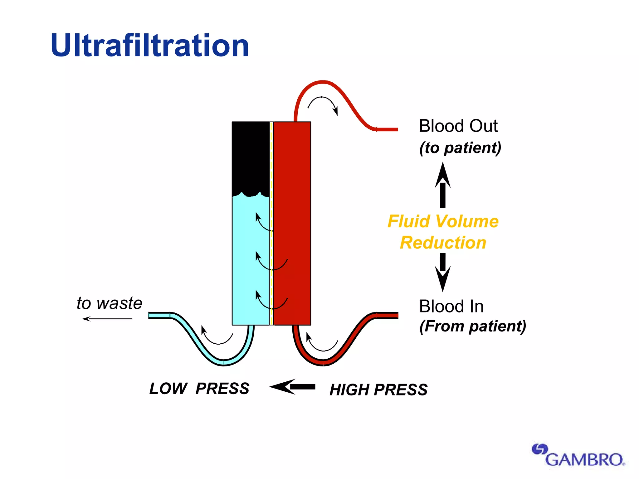 Ultrafiltration Blood Out Blood In to waste (to patient) (From patient) HIGH PRESS LOW  PRESS Fluid Volume Reduction 
