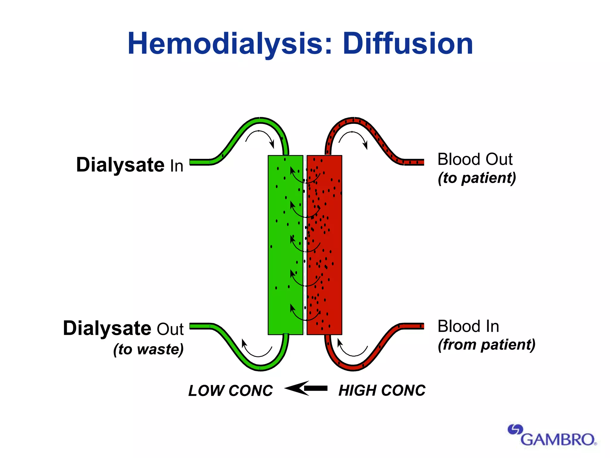 Hemodialysis: Diffusion Dialysate  In Dialysate  Out (to waste) Blood Out Blood In (to patient) (from patient) HIGH CONC LOW CONC 