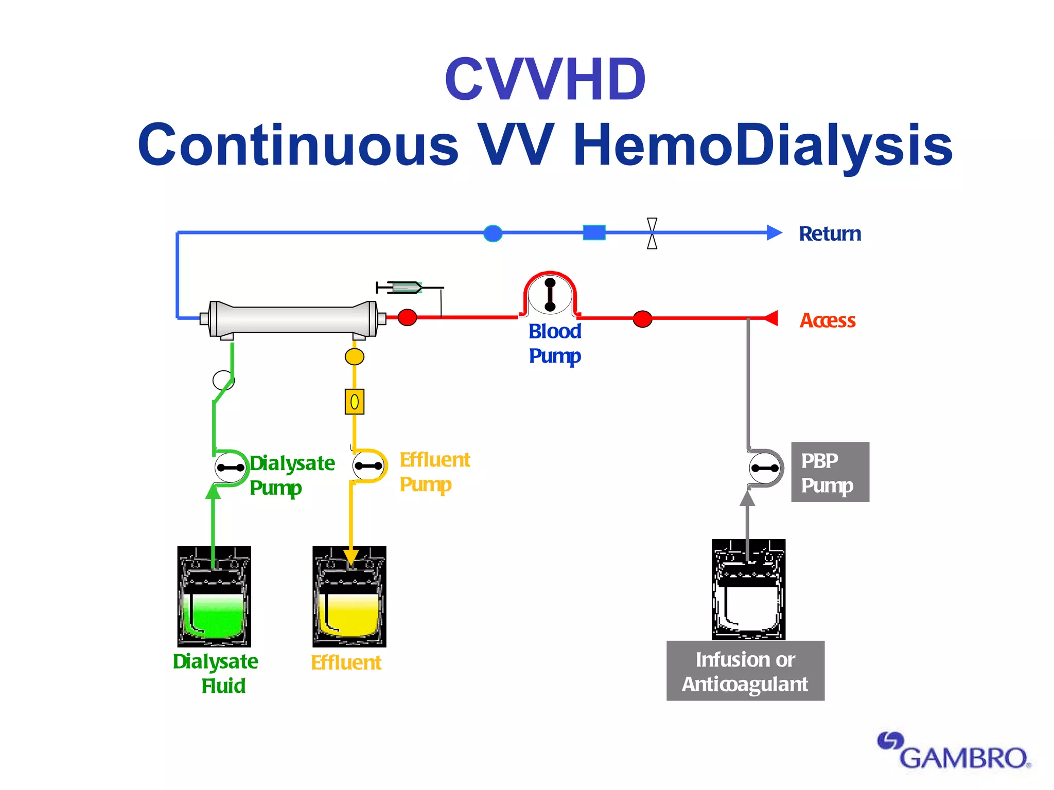 CVVHD Continuous VV HemoDialysis Hemofilter Effluent Pump Effluent Access Return Dialysate Pump Dialysate Fluid Blood Pump Infusion or Anticoagulant PBP Pump 