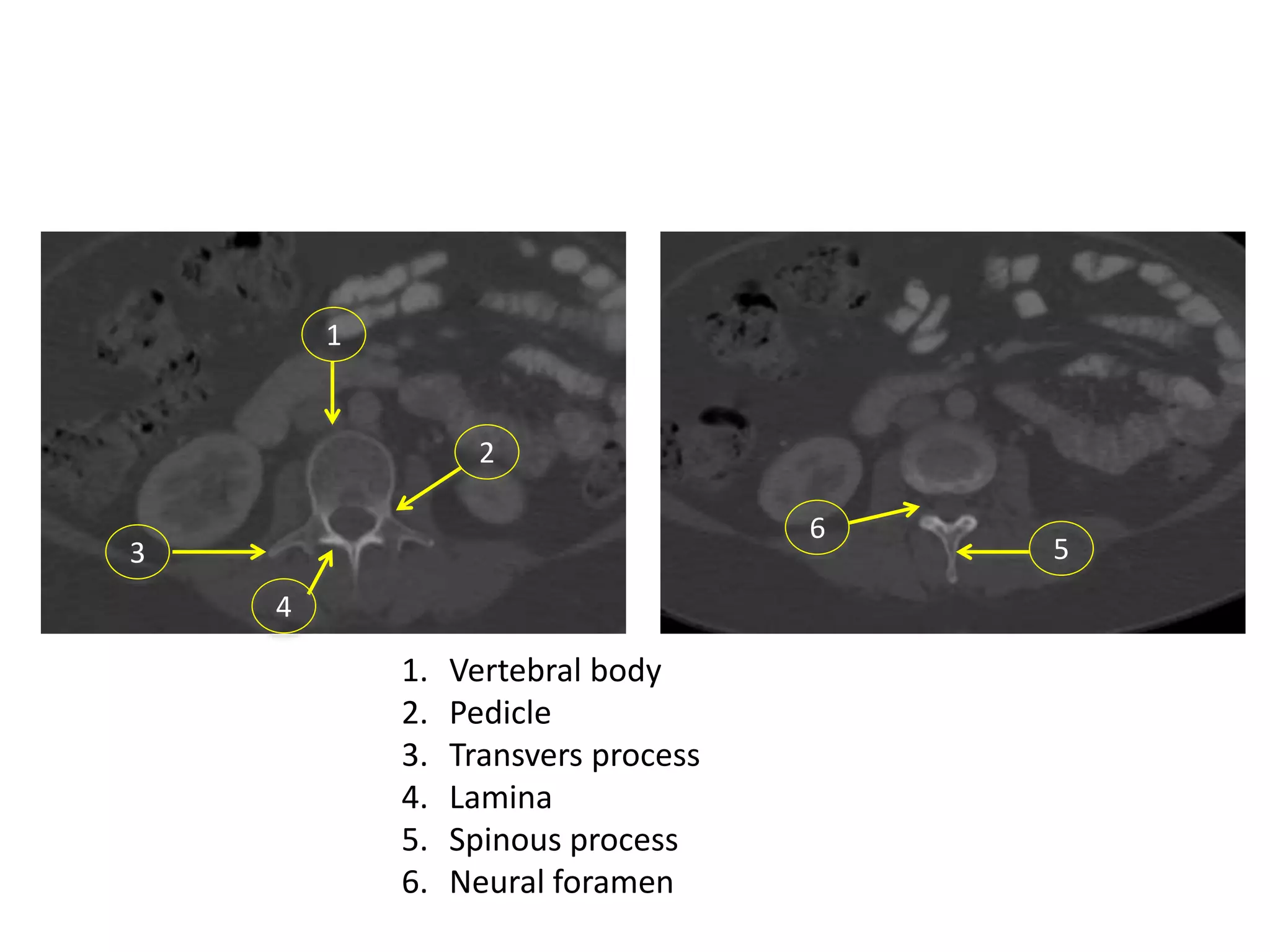 1-Radiological anatomy of spine.ppt