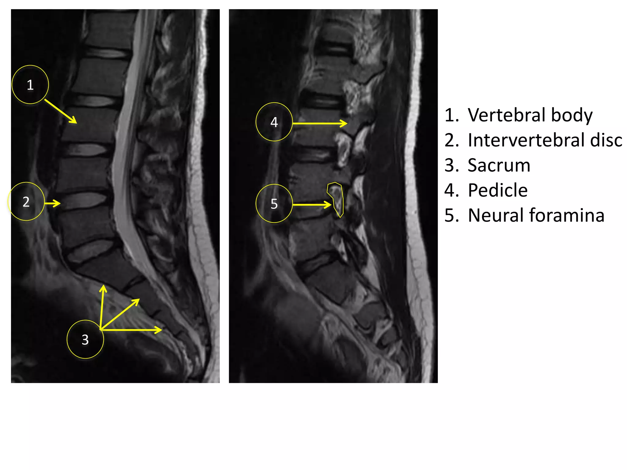 1-Radiological anatomy of spine.ppt