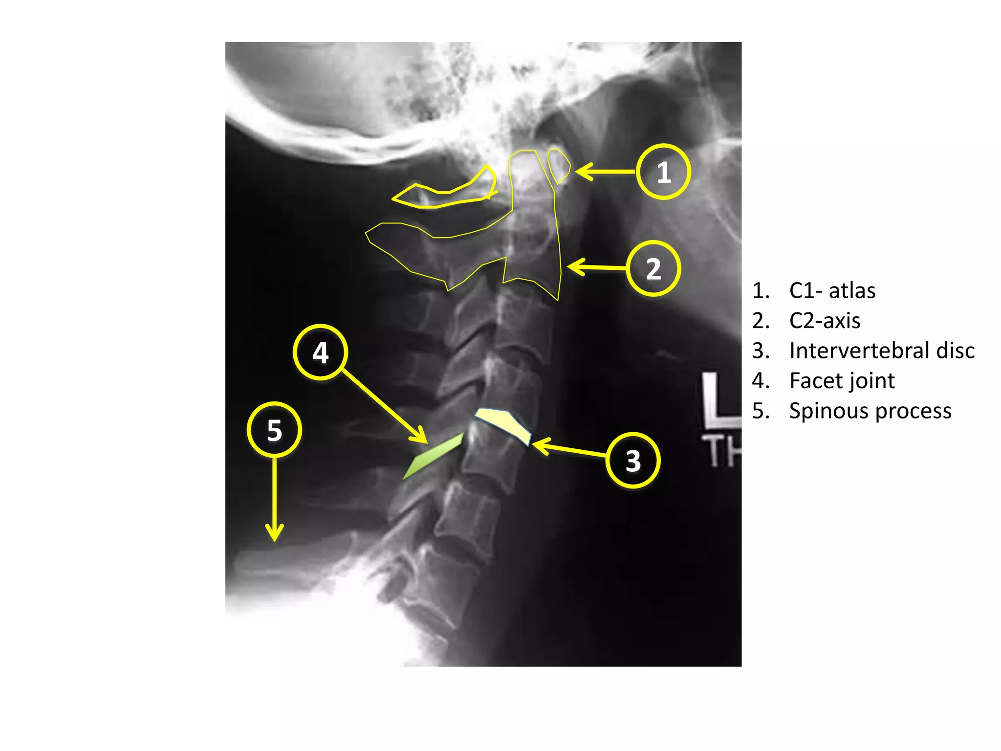 1-Radiological anatomy of spine.ppt