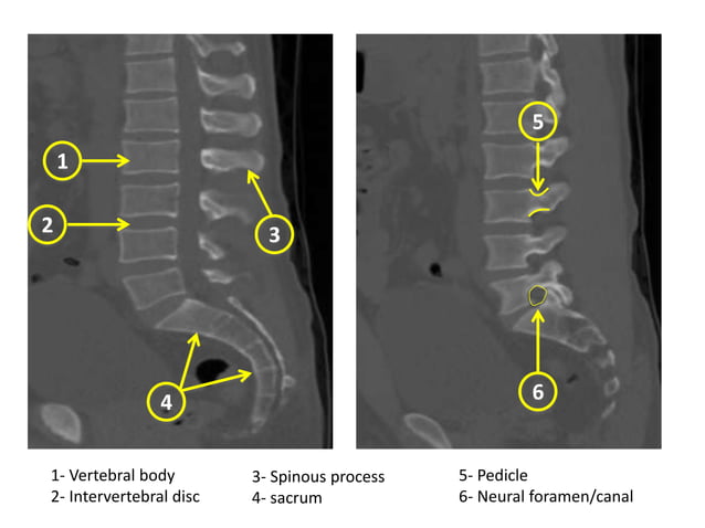 1-Radiological anatomy of spine.ppt