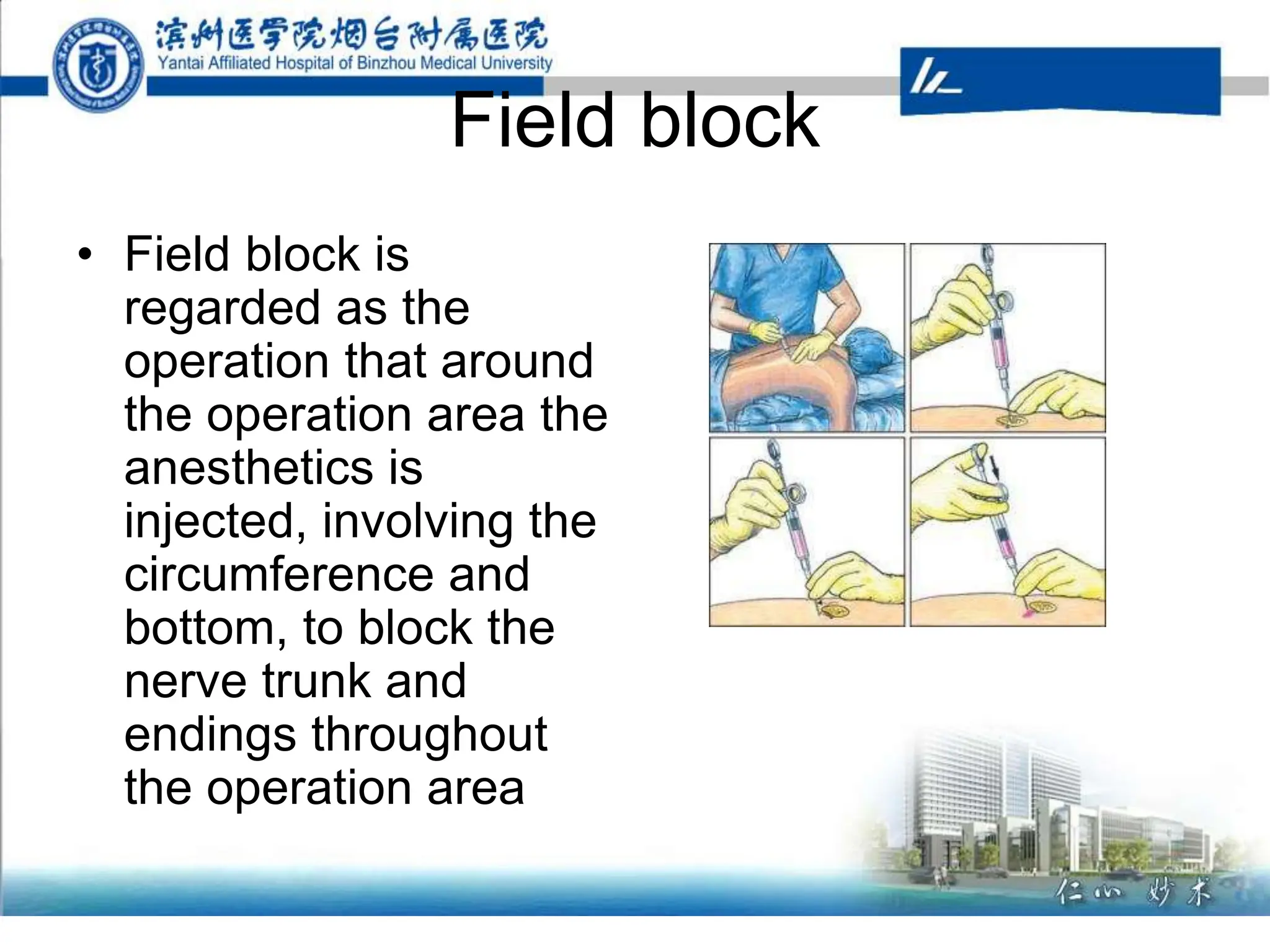 Field block
• Field block is
regarded as the
operation that around
the operation area the
anesthetics is
injected, involving the
circumference and
bottom, to block the
nerve trunk and
endings throughout
the operation area
 