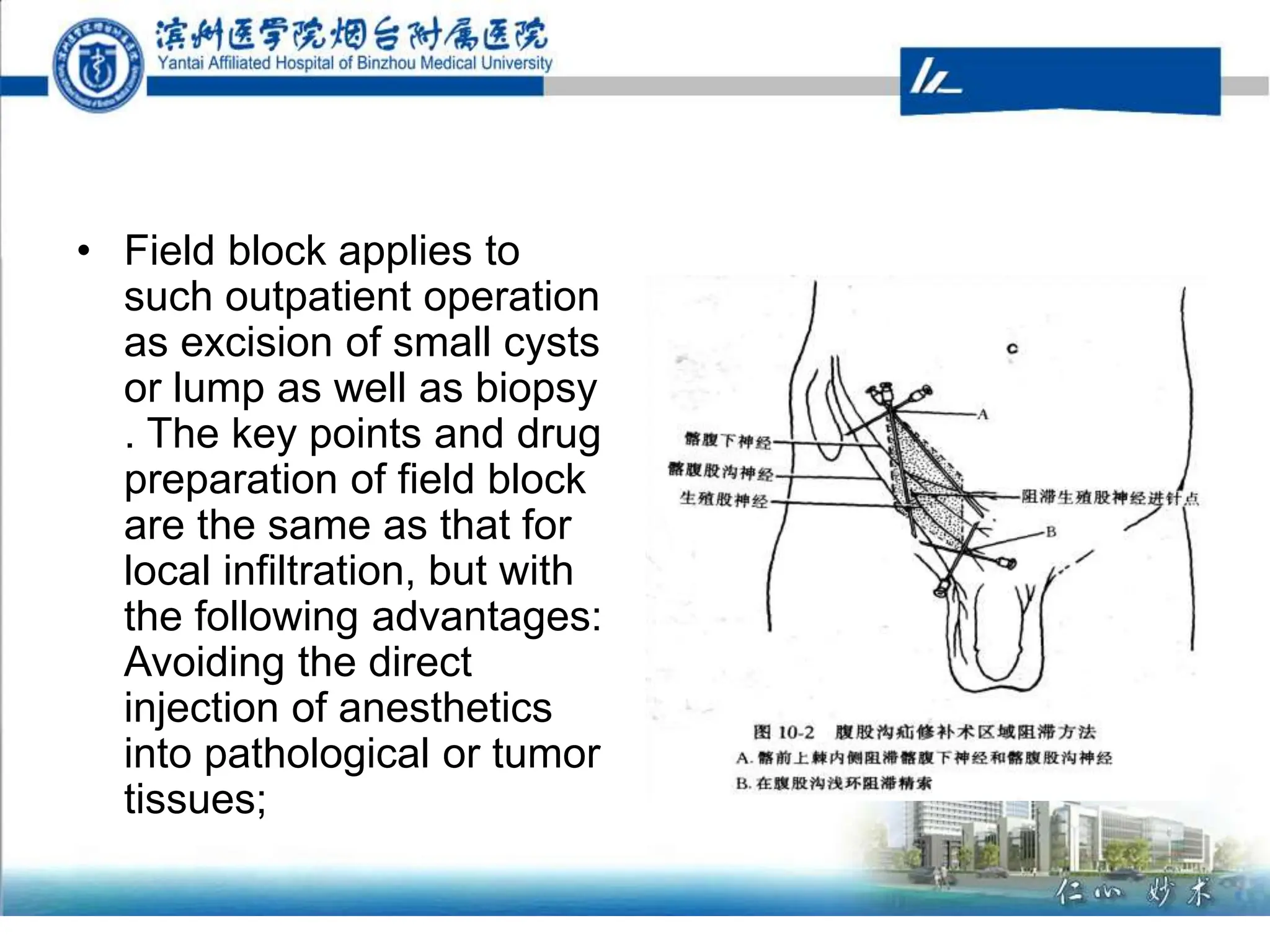 • Field block applies to
such outpatient operation
as excision of small cysts
or lump as well as biopsy
. The key points and drug
preparation of field block
are the same as that for
local infiltration, but with
the following advantages:
Avoiding the direct
injection of anesthetics
into pathological or tumor
tissues;
 