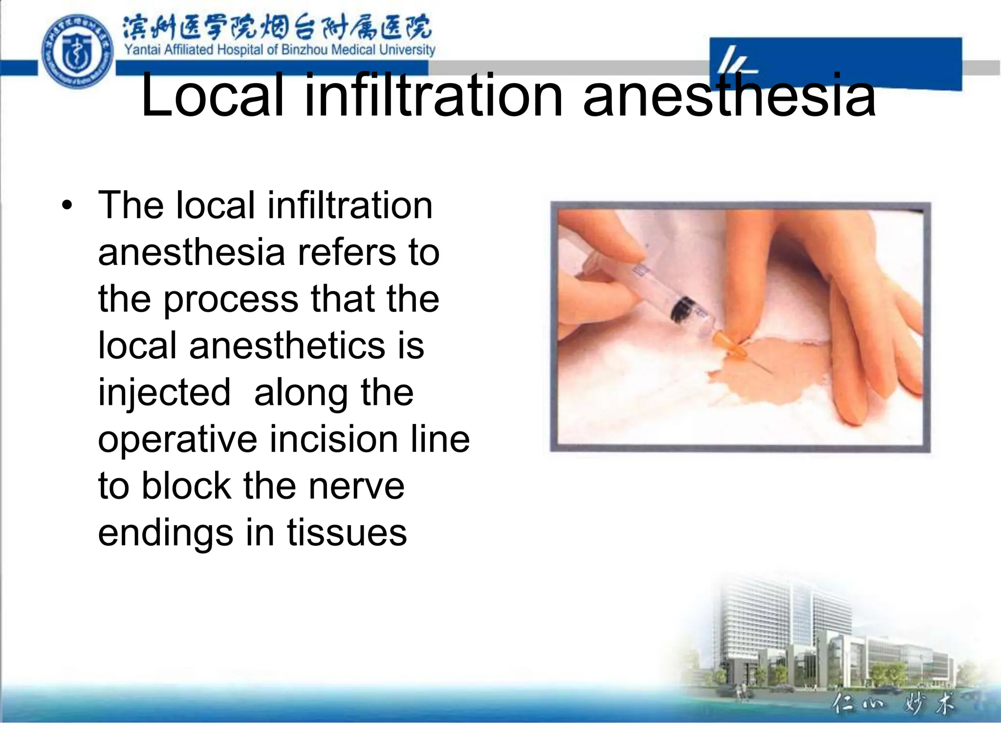 Local infiltration anesthesia
• The local infiltration
anesthesia refers to
the process that the
local anesthetics is
injected along the
operative incision line
to block the nerve
endings in tissues
 