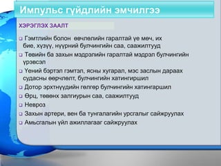 Импульс гүйдлийн эмчилгээ
ХЭРЭГЛЭХ ЗААЛТ

 Гэмтлийн болон өвчлөлийн гаралтай үе мөч, их
 бие, хүзүү, нүүрний булчингийн саа, саажилтууд
 Төвийн ба захын мэдрэлийн гаралтай мэдрэл булчингийн
 үрэвсэл
 Үений бэртэл гэмтэл, ясны хугарал, мэс заслын дараах
 судасны өөрчлөлт, булчингийн хатингиршил
 Дотор эрхтнүүдийн гөлгөр булчингийн хатингаршил

 Өрц, төвөнх залгиурын саа, саажилтууд

 Невроз

 Захын артери, вен ба тунгалагийн урсгалыг сайжруулах

 Амьсгалын үйл ажиллагааг сайжруулах
 