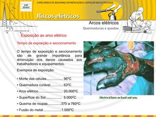 Tempo de exposição e seccionamento
O tempo de exposição e seccionamento
são de grande importância para
diminuição dos danos causados aos
trabalhadores e equipamentos.
Exemplos de exposição:
• Morte das células................. 960C
• Queimadura curável............. 630C
• Arco elétrico......................... 20.0000C
• Superfície do Sol................. 5.0000C
• Queima de roupas..............370 a 7600C
• Fusão do metal...................1.0000C
Exposição ao arco elétrico
Arcos elétricos
Queimaduras e quedas
 