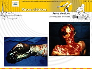 Arcos elétricos
Queimaduras e quedas
19:25:10
 