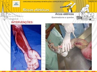 INTERVENÇÕES:
Arcos elétricos
Queimaduras e quedas
19:25:10
 