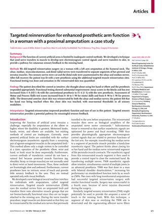Articles



Targeted reinnervation for enhanced prosthetic arm function
in a woman with a proximal amputation: a case study
Todd A Kuiken, Laura A Miller, Robert D Lipschutz, Blair A Lock, Kathy Stubbleﬁeld, Paul D Marasco, Ping Zhou, Gregory A Dumanian

Summary
Background The function of current artiﬁcial arms is limited by inadequate control methods. We developed a technique                   Lancet 2007; 369: 371–80
that used nerve transfers to muscle to develop new electromyogram control signals and nerve transfers to skin, to                      See Comment page 345
provide a pathway for cutaneous sensory feedback to the missing hand.                                                                  Neural Engineering Center for
                                                                                                                                       Artiﬁcial Limbs, Rehabilitation
                                                                                                                                       Institute of Chicago, Chicago,
Methods We did targeted reinnervation surgery on a woman with a left arm amputation at the humeral neck. The
                                                                                                                                       IL 60611, USA
ulnar, median, musculocutaneous, and distal radial nerves were transferred to separate segments of her pectoral and                    (Prof T A Kuiken MD,
serratus muscles. Two sensory nerves were cut and the distal ends were anastomosed to the ulnar and median nerves.                     Prof G A Dumanian MD,
After full recovery the patient was ﬁt with a new prosthesis using the additional targeted muscle reinnervation sites.                 Prof L A Miller PhD,
                                                                                                                                       R D Lipschutz CP, B A Lock MS,
Functional testing was done and sensation in the reinnervated skin was quantiﬁed.
                                                                                                                                       K Stubbleﬁeld OT,
                                                                                                                                       P D Marasco PhD,
Findings The patient described the control as intuitive; she thought about using her hand or elbow and the prosthesis                  Prof P Zhou PhD); Department
responded appropriately. Functional testing showed substantial improvement: mean scores in the blocks and box test                     of Physical Medicine and
                                                                                                                                       Rehabilitation (T A Kuiken,
increased from 4·0 (SD 1·0) with the conventional prosthesis to 15·6 (1·5) with the new prosthesis. Assessment of
                                                                                                                                       L A Miller, P Zhou) and
Motor and Process Skills test scores increased from 0·30 to 1·98 for motor skills and from 0·90 to 1·98 for process                    Department of Surgery,
skills. The denervated anterior chest skin was reinnervated by both the ulnar and median nerves; the patient felt that                 Division of Plastic Surgery
her hand was being touched when this chest skin was touched, with near-normal thresholds in all sensory                                (G A Dumanian), Feinberg
                                                                                                                                       School of Medicine,
modalities.
                                                                                                                                       Northwestern University,
                                                                                                                                       Chicago, IL, USA; and
Interpretation Targeted reinnervation improved prosthetic function and ease of use in this patient. Targeted sensory                   Biomedical Engineering
reinnervation provides a potential pathway for meaningful sensory feedback.                                                            Department, Northwestern
                                                                                                                                       University, Evanston, IL, USA
                                                                                                                                       (T A Kuiken)
Introduction                                                             travelled to the arm before amputation. The reinnervated
                                                                                                                                       Correspondence to:
Improving the function of artiﬁcial arms remains a                       muscles then serve as biological ampliﬁers of the             Prof Todd A Kuiken
challenge, especially for amputations at the elbow or                    amputated nerve motor commands.2,3 Subcutaneous               tkuiken@northwestern.edu
higher, where the disability is greatest. Motorised hooks,               tissue is removed so that surface myoelectric signals are
hands, wrists, and elbows are available, but existing                    optimised for power and focal recording. TMR thus
methods of control are inadequate. Currently, most                       provides physiologically appropriate electromyogram
powered artiﬁcial limbs are controlled with the surface                  control signals that are related to previous functions of
electromyogram (myoelectric signals) from a remaining                    the lost arm. For example, transferring the median nerve
pair of agonist-antagonist muscles in the amputated limb.1               to a segment of pectoralis muscle provides a hand-close
This method allows only a single motion to be controlled                 myoelectric signal. The patient thinks about closing his
at a time; operation of the prosthetic elbow, wrist and                  or her hand and the median nerve reinnervated segment
hand, or hook must be done sequentially. Furthermore,                    of the pectoralis muscle contracts. The myoelectric signal
current methods of myoelectric control do not have a                     from this reinnervated muscle segment is then used to
natural feel because proximal muscle functions (eg,                      provide a control input to close the motorised hand. By
shoulder, bicep, or triceps muscles) are not normally used               transferring multiple nerves, TMR myoelectric signals
to direct wrist or hand movements. Thus, these methods                   allow intuitive, simultaneous control of multiple joints in
are frustratingly slow and awkward. Furthermore, current                 an advanced prosthesis. TMR was ﬁrst done in a man
prostheses have no intrinsic sense of touch and provide                  with bilateral shoulder disarticulation,4,5 increasing his
little sensory feedback to the user. They are instead                    performance on standardised function tests by as much
operated only with visual feedback.                                      as 250%. Two men with long transhumeral amputations
   We developed a new biological neural machine interface                had successful targeted reinnervation surgery with
for individuals with amputations, called targeted                        similar functional results. Surgery was unsuccessful in
reinnervation. Targeted muscle reinnervation (TMR)                       a fourth man, because of nerve injuries discovered
uses the residual nerves from an amputated limb and                      during the surgery.
transfers them onto alternative muscle groups that are                     Similarly, targeted sensory reinnervation (TSR) might
not biomechanically functional since they are no longer                  potentially be used to provide the amputee a sense of
attached to the missing arm. During the nerve transfer                   touch in the missing limb. With this technique, a
procedure, target muscles are denervated so that they can                segment of skin near or overlying the TMR site is
be reinnervated by the residual arm nerves that previously               denervated and the regenerating aﬀerent nerve ﬁbres


www.thelancet.com Vol 369 February 3, 2007                                                                                                                        371
 