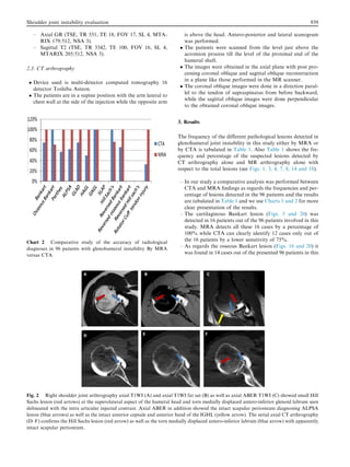 – Axial GR (TSE, TR 551, TE 18, FOV 17, SL 4, MTA-
RIX 179/512, NSA 3).
– Sagittal T2 (TSE, TR 3342, TE 100, FOV 16, SL 4,
MTARIX 205/512, NSA 3).
2.3. CT arthrography
 Device used is multi-detector computed tomography 16
detector Toshiba Asteon.
 The patients are in a supine position with the arm lateral to
chest wall at the side of the injection while the opposite arm
is above the head. Antero-posterior and lateral scanogram
was performed.
 The patients were scanned from the level just above the
acromion process till the level of the proximal end of the
humeral shaft.
 The images were obtained in the axial plane with post pro-
cessing coronal oblique and sagittal oblique reconstruction
in a plane like those performed in the MR scanner.
 The coronal oblique images were done in a direction paral-
lel to the tendon of supraspinatus from before backward,
while the sagittal oblique images were done perpendicular
to the obtained coronal oblique images.
3. Results
The frequency of the different pathological lesions detected in
glenohumeral joint instability in this study either by MRA or
by CTA is tabulated in Table 1. Also Table 1 shows the fre-
quency and percentage of the suspected lesions detected by
CT arthrography alone and MR arthrography alone with
respect to the total lesions (see Figs. 1, 3, 4, 7, 8, 14 and 18).
– In our study a comparative analysis was performed between
CTA and MRA ﬁndings as regards the frequencies and per-
centage of lesions detected in the 96 patients and the results
are tabulated in Table 1 and we use Charts 1 and 2 for more
clear presentation of the results.
– The cartilaginous Bankart lesion (Figs. 5 and 20) was
detected in 16 patients out of the 96 patients involved in this
study. MRA detects all these 16 cases by a percentage of
100% while CTA can clearly identify 12 cases only out of
the 16 patients by a lower sensitivity of 75%.
– As regards the osseous Bankart lesion (Figs. 16 and 20) it
was found in 14 cases out of the presented 96 patients in this
Chart 2 Comparative study of the accuracy of radiological
diagnoses in 96 patients with glenohumeral instability By MRA
versus CTA.
Fig. 2 Right shoulder joint arthrography axial T1WI (A) and axial T1WI fat sat (B) as well as axial ABER T1WI (C) showed small Hill
Sachs lesion (red arrows) at the superolateral aspect of the humeral head and torn medially displaced antero-inferior glenoid labrum seen
delineated with the intra articular injected contrast. Axial ABER in addition showed the intact scapular periosteum diagnosing ALPSA
lesion (blue arrows) as well as the intact anterior capsule and anterior band of the IGHL (yellow arrow). The serial axial CT arthrography
(D–F) conﬁrms the Hill Sachs lesion (red arrow) as well as the torn medially displaced antero-inferior labrum (blue arrow) with apparently
intact scapular periosteum.
Shoulder joint instability evaluation 939
 