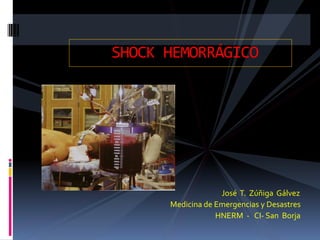 José T. Zúñiga Gálvez
Medicina de Emergencias y Desastres
HNERM - CI- San Borja
SHOCK HEMORRÁGICO
 