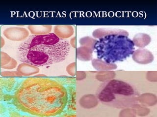 PLAQUETAS (TROMBOCITOS) 
