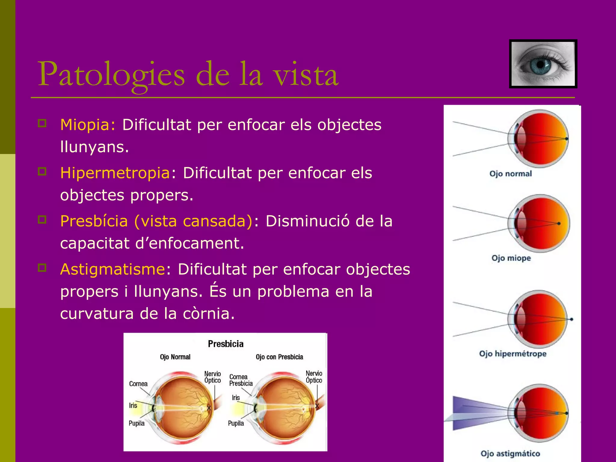 Patologies de la vista
 Miopia: Dificultat per enfocar els objectes
llunyans.
 Hipermetropia: Dificultat per enfocar els
objectes propers.
 Presbícia (vista cansada): Disminució de la
capacitat d’enfocament.
 Astigmatisme: Dificultat per enfocar objectes
propers i llunyans. És un problema en la
curvatura de la còrnia.
 
