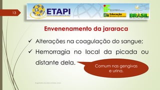 Engenheiro Zacarias Linhares Junior
1313
Envenenamento da jararaca
 Alterações na coagulação do sangue;
 Hemorragia no local da picada ou
distante dela. Comum nas gengivas
e urina.
 