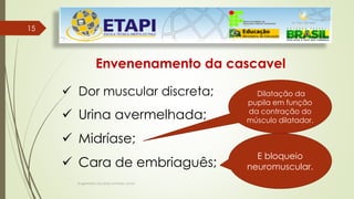 Engenheiro Zacarias Linhares Junior
1515
Envenenamento da cascavel
 Dor muscular discreta;
 Urina avermelhada;
 Midríase;
 Cara de embriaguês;
E bloqueio
neuromuscular.
Dilatação da
pupila em função
da contração do
músculo dilatador.
 