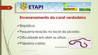 Engenheiro Zacarias Linhares Junior
2020
Envenenamento da coral verdadeira
Elapídico;
Pequena reação no local da picada;
Dificuldade em abrir os olhos;
Pálpebra caída;
Fonte: www.hospvirt.org.br.
 
