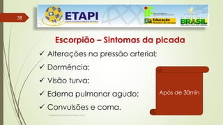Engenheiro Zacarias Linhares Junior
3838
Escorpião – Sintomas da picada
 Alterações na pressão arterial;
 Dormência;
 Visão turva;
 Edema pulmonar agudo;
 Convulsões e coma.
Após de 30min
 