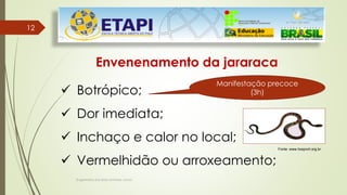 Engenheiro Zacarias Linhares Junior
12
12
Envenenamento da jararaca
 Botrópico;
 Dor imediata;
 Inchaço e calor no local;
 Vermelhidão ou arroxeamento;
Manifestação precoce
(3h)
Fonte: www.hospvirt.org.br.
 