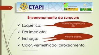 Engenheiro Zacarias Linhares Junior
17
17
Envenenamento da surucuru
 Laquético;
 Dor imediata;
 Inchaço;
 Calor, vermelhidão, arroxeamento.
Manifestação precoce
(3h)
No local picado.
No local picado.
 