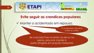 Engenheiro Zacarias Linhares Junior
30
30
Evite seguir as crendices populares
 Manter o acidentado em repouso.
Se a picada tiver ocorrido no pé ou na
perna, procurar manter a
parte atingida em posição horizontal.
O acidentado não deve
andar ou correr.
 