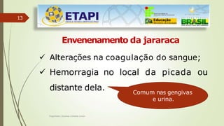 13
Envenenamento da jararaca
 Alterações na coagulação do sangue;
 Hemorragia no local da picada ou
distante dela. Comum nas gengivas
e urina.
Engenheiro Zacarias Linhares Junior
 
