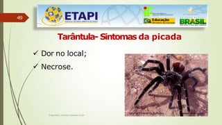 49
Tarântula- Sintomas da picada
 Dor no local;
 Necrose.
Engenheiro Zacarias Linhares Junior
 