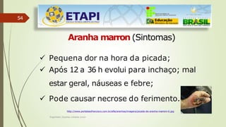 54
Aranha marron (Sintomas)
 Pequena dor na hora da picada;
 Após 12 a 36 h evolui para inchaço; mal
estar geral, náuseas e febre;
 Pode causar necrose do ferimento.
http://www.portalsaofrancisco.com.br/alfa/aranhas/imagens/picada-de-aranha-marrom-6.jpg
Engenheiro Zacarias Linhares Junior
 