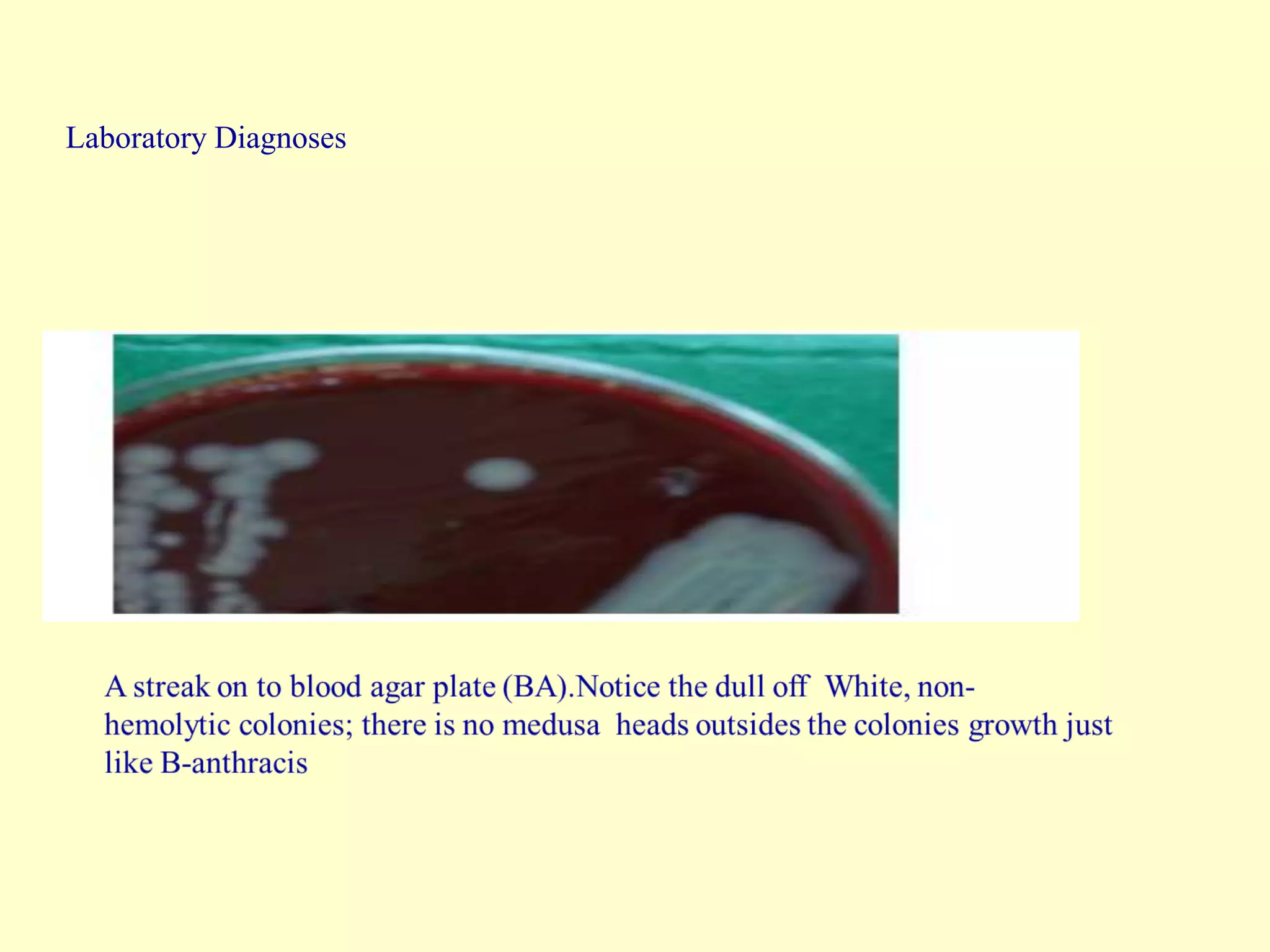 Laboratory Diagnoses

 