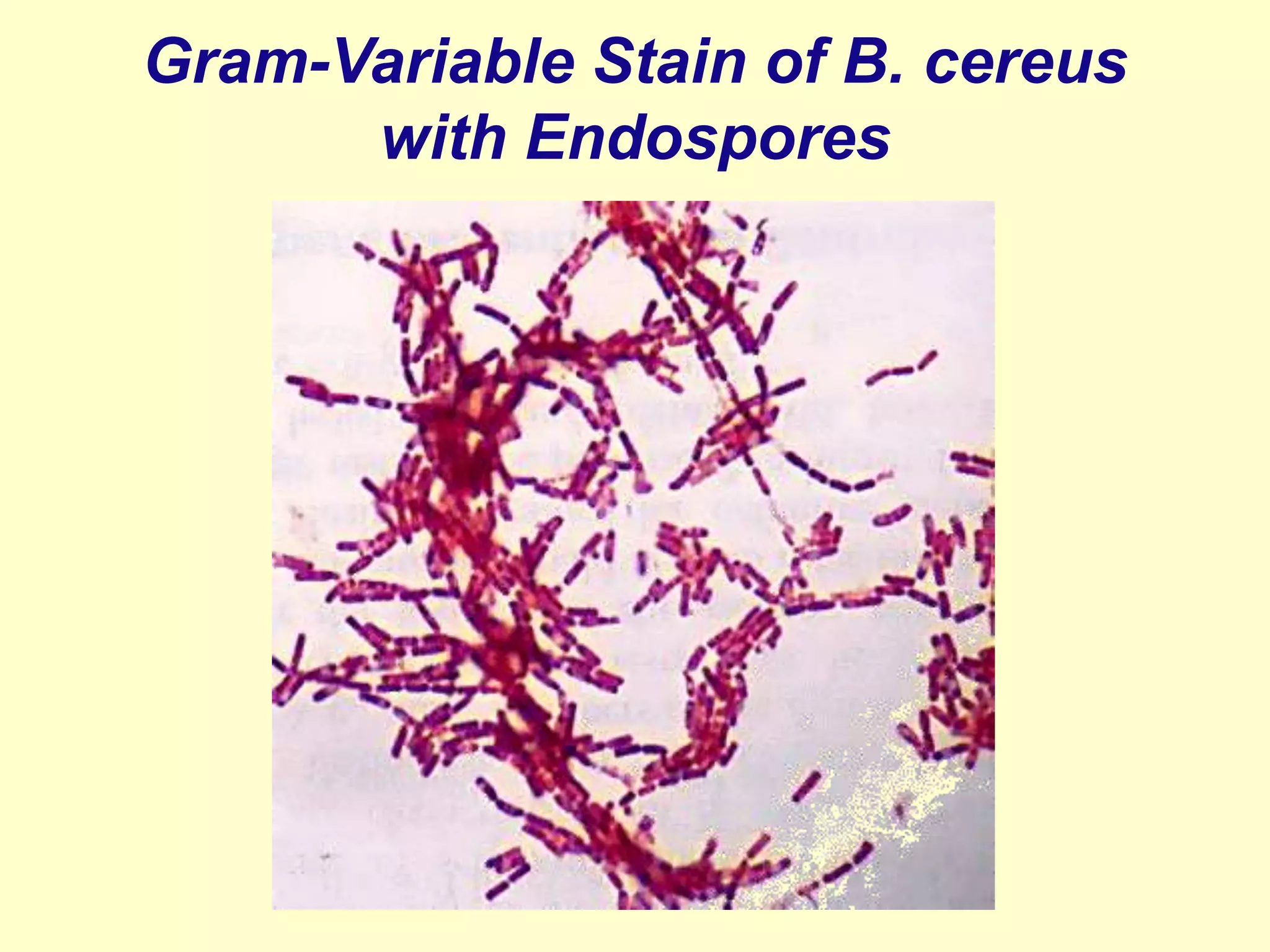 Gram-Variable Stain of B. cereus
with Endospores

 