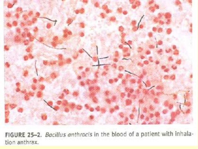 bacillus cereus gram stain