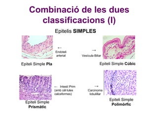 Combinació de les dues classificacions (I) Epiteli Simple  Pla Epiteli Simple  Prismàtic Epiteli Simple  Cúbic Epitelis  SIMPLES Epiteli Simple  Polimòrfic ←  Intestí Prim  (amb cèl·lules calceformes) Vesícula Biliar -> Endoteli arterial ← Carcinoma lobulillar -> 