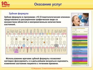 Зубная формула
Зубная формула в программе «1С:Стоматологическая клиника»
представлена в расширенном графическом виде со
множеством областей и неограниченным количеством
состояний.
Использование врачами зубной формулы позволяет
наглядно фиксировать и в дальнейшем визуально оценивать
изменение состояние пациента с течением времени.
1С:Медицина. Стоматологическая клиника
Оказание услуг
 