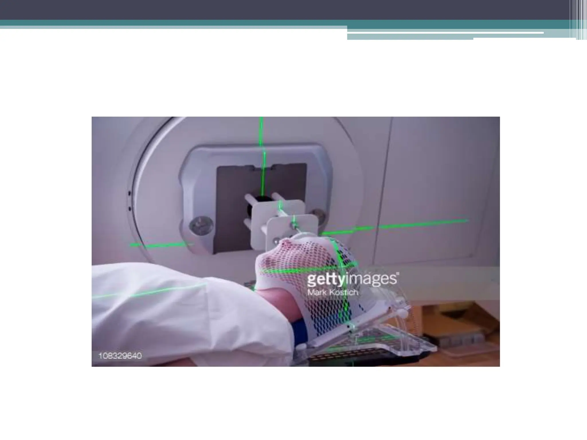 Radiotherapy ppt. Types of radiation and chronic | PPTX