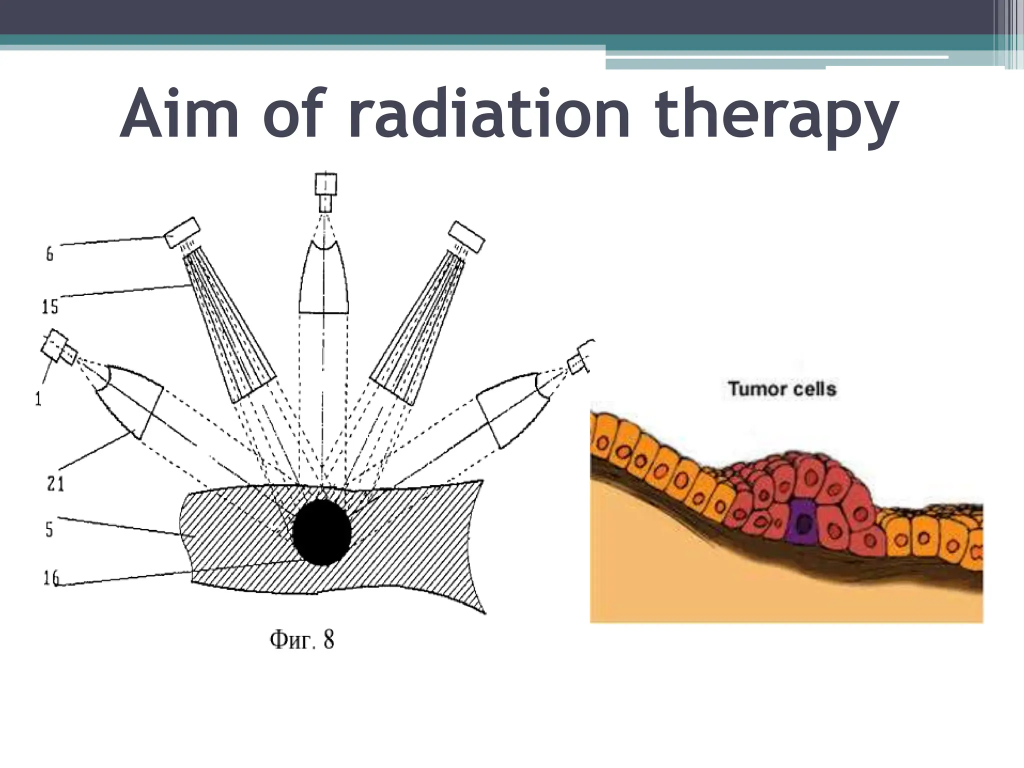 Radiotherapy ppt. Types of radiation and chronic | PPTX